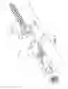 Fig. 08 - Rod capture mechanism for dynamic stabilization and motion preservation spinal implantation system and method