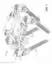 Fig. 02 - Reinforced bone anchor for a dynamic stabilization and motion preservation spinal implantation system and method