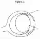 Fig. 04 - Method and apparatus for imaging an eye of a small animal