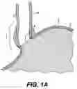 Fig. 02 - Tissue patches and related delivery systems and methods
