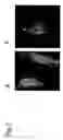 Fig. 03 - Method by Using Human or Mice-Isg12 to Develop and Prepare Drugs and  Single Nucleotide Polymorphism in the Isg12 Gene for Diagnostic Use