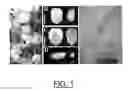 Fig. 02 - EMP4 gene