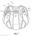 Fig. 07 - Portable light