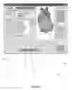 Fig. 07 - Medical Data Signal Processing Systems