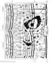 Fig. 08 - Materials, Methods, and Systems for Cavitation-mediated Ultrasonic Drug Delivery in vivo