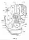 Fig. 03 - BASEBALL GLOVES WITH AN ADAPTABLE INDEX FINGER STALL AND METHODS OF MAKING SAME