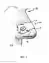 Fig. 02 - Nasal devices including dilation and user communication and methods of using same