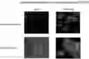 Fig. 01 - HSC70 directed diagnostics and therapeutics for multidrug resistant neoplastic disease