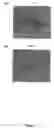 Fig. 02 - HSC70 directed diagnostics and therapeutics for multidrug resistant neoplastic disease