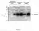Fig. 08 - HSC70 directed diagnostics and therapeutics for multidrug resistant neoplastic disease