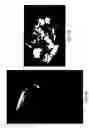 Fig. 07 - Macrophage-Enhanced MRI (MEMRI)