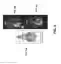 Fig. 06 - In vivo cell trafficking