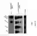 Fig. 23 - COMPOSITIONS AND METHODS INVOLVING GENE THERAPY AND PROTEASOME MODULATION