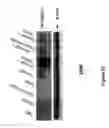 Fig. 32 - COMPOSITIONS AND METHODS INVOLVING GENE THERAPY AND PROTEASOME MODULATION