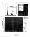 Fig. 32 - Prospective identification and characterization of breast cancer stem cells
