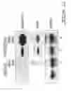 Fig. 11 - Polynucleotides and polypeptide sequences involved in the process of bone remodeling