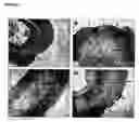 Fig. 09 - METHODS FOR TREATING AND AMELIORATING THE SYMPTONS OF INFLAMMATORY BOWEL DISEASES