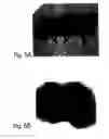Fig. 08 - 7B2 Knockout transgenic animals as models of endocrine disease