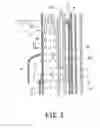 Fig. 04 - REACTIVITY CONTROL ROD FOR CORE, CORE OF NUCLEAR REACTOR, NUCLEAR REACTOR AND NUCLEAR POWER PLANT
