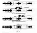Fig. 11 - Method and device for determining a room acoustic impulse response in the time domain