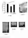 Fig. 72 - Methods of Cell Therapy, Neurogenesis and Oligodendrogenesis