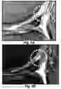 Fig. 13 - Methods and compositions for optimized expansion and implantation of mesenchymal stem cells