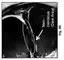 Fig. 17 - Methods and compositions for optimized expansion and implantation of mesenchymal stem cells