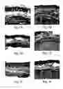 Fig. 02 - Muscle derived cells for the treatment of cardiac pathologies and methods of making and using the same