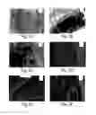 Fig. 06 - Muscle derived cells for the treatment of cardiac pathologies and methods of making and using the same