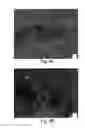 Fig. 10 - Muscle derived cells for the treatment of cardiac pathologies and methods of making and using the same