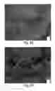 Fig. 11 - Muscle derived cells for the treatment of cardiac pathologies and methods of making and using the same