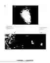 Fig. 03 - Embryonic Stem Cell Derivatives, and Methods of Making and Using the Same