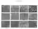 Fig. 15 - Steroid lipid-modified polyurethane as an implantable biomaterial, the preparation and uses thereof