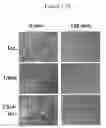 Fig. 21 - Steroid lipid-modified polyurethane as an implantable biomaterial, the preparation and uses thereof