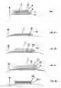 Fig. 02 - Drug-delivery patch comprising a dissolvable layer and uses thereof