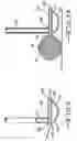 Fig. 05 - Mini-face blade putter