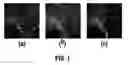 Fig. 02 - System and method for two-dimensional visualization of temporal phenomena and three dimensional vessel reconstruction