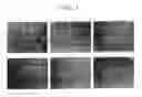Fig. 04 - Malignant tumor-inhibiting preparation comprising Des A fibrin