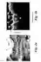 Fig. 03 - OPTICAL COHERENCE TOMOGRAPHY