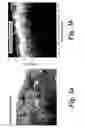 Fig. 04 - OPTICAL COHERENCE TOMOGRAPHY