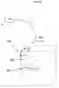Fig. 04 - Ultrasonic bone motion tracking system