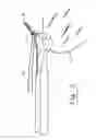 Fig. 06 - Suture passing and retrieval device