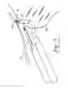Fig. 07 - Suture passing and retrieval device