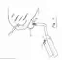 Fig. 08 - Suture passing and retrieval device