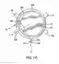 Fig. 09 - Accommodating intraocular lenses and associated systems, frames, and methods