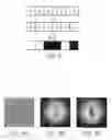 Fig. 08 - Method and apparatus for phase-encoded homogenized Fourier transform holographic data storage and recovery