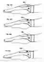 Fig. 08 - Versatile stun glove