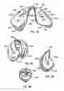 Fig. 30 - Collapsible structures having enhancements