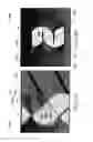 Fig. 08 - Apparatus and method for providing detonation damage resistance in ductwork