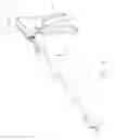 Fig. 06 -  DEVICE FOR INSUFFLATING THE INTERIOR OF A GASTRIC CAVITY OF A PATIENT